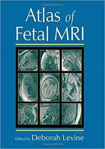 Atlas of Fetal MRI