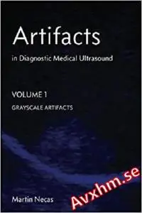 Artifacts in Diagnostic Medical Ultrasound: Grayscale Artifacts