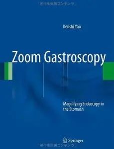 Zoom Gastroscopy: Magnifying Endoscopy in the Stomach [Repost]
