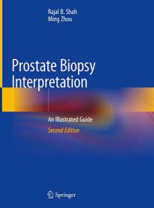 Prostate Biopsy Interpretation: An Illustrated Guide (Repost)
