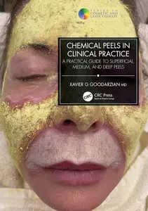 Chemical Peels in Clinical Practice: A Practical Guide to Superficial