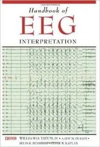 Handbook of Eeg Interpretation by Dr. William O. Tatum DO