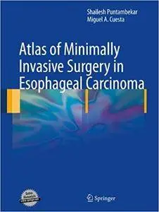 Atlas of Minimally Invasive Surgery in Esophageal Carcinoma (Repost)