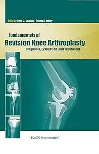 Fundamentals of Revision Knee Arthroplasty: Diagnosis, Evaluation, and Treatment