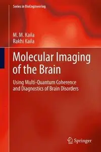 Molecular Imaging of the Brain: Using Multi-Quantum Coherence and Diagnostics of Brain Disorders (Repost)