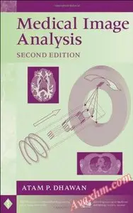 Medical Image Analysis