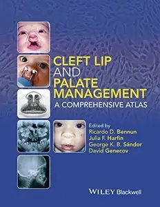 Cleft Lip and Palate Management: A Comprehensive Atlas (repost)