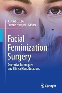 Facial Feminization Surgery