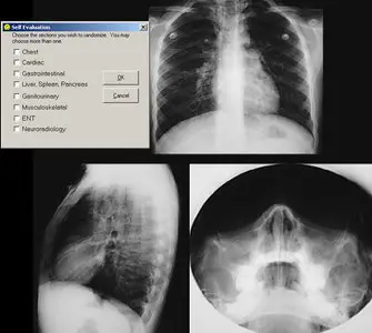 Pediatric Radiology: The Learning File CD-ROM - American College of Radiology (ACR) 