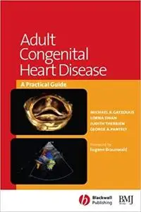 Adult Congenital Heart Disease: A Practical Guide