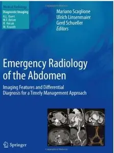 Emergency Radiology of the Abdomen: Imaging Features and Differential Diagnosis for a Timely Management Approach (repost)