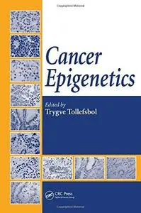 Cancer Epigenetics