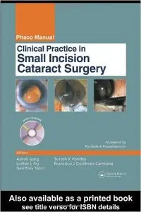 Clinical Practice in Small Incision Cataract Surgery: (Phaco Manual)