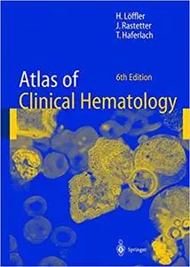 Atlas of Clinical Hematology Ed 6