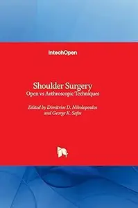 Shoulder Surgery - Open vs Arthroscopic Techniques