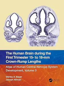 The Human Brain during the First Trimester 15- to 18-mm Crown-Rump Lengths (Repost)