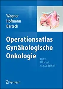 Operationsatlas Gynäkologische Onkologie