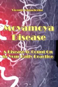 "Moyamoya Disease: A Disease to Count On in Your Daily Practice" ed. by Vicente Vanacloch