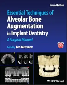 Essential Techniques of Alveolar Bone Augmentation in Implant Dentistry: A Surgical Manual (Repost)
