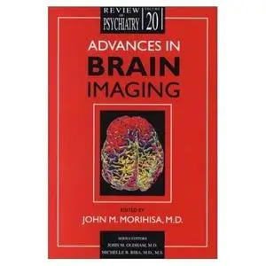 John M. Morihisa (Editor), «Advances in Brain Imaging»