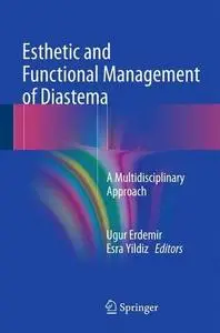 Esthetic and Functional Management of Diastema: A Multidisciplinary Approach