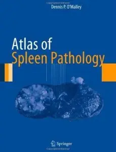 Atlas of Spleen Pathology