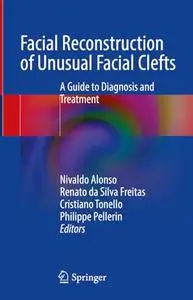 Facial Reconstruction of Unusual Facial Clefts: A Guide to Diagnosis and Treatment