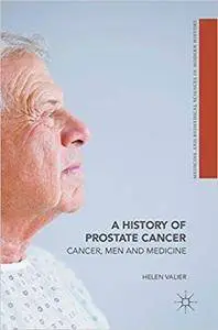 A History of Prostate Cancer: Cancer, Men and Medicine