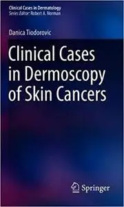 Clinical Cases in Dermoscopy of Skin Cancers