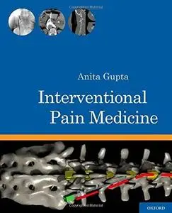 Interventional pain medicine