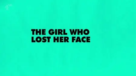 Channel 4 - Unreported World: The Girl who Lost her Face (2015)