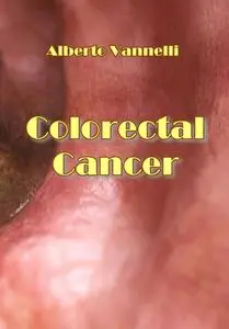 "Colorectal Cancer" ed. by Alberto Vannelli