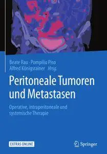Peritoneale Tumoren und Metastasen: Operative, intraperitoneale und systemische Therapie