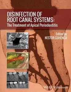 Disinfection of Root Canal Systems: The Treatment of Apical Periodontitis (repost)