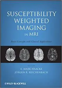 Susceptibility Weighted Imaging in MRI: Basic Concepts and Clinical Applications (Repost)