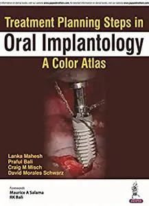 Treatment Planning Steps in Oral Implantology: A Color Atlas