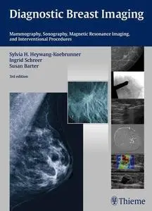Diagnostic Breast Imaging: Mammography, Sonography, Magnetic Resonance Imaging, and Interventional Procedures