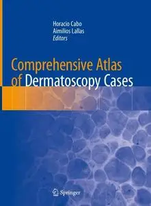 Comprehensive Atlas of Dermatoscopy Cases (Reopst)
