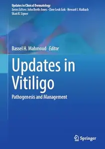 Updates in Vitiligo: Pathogenesis and Management