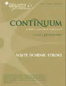 Acute Ischemic Stroke by CONTINUUM - American Academy of Neurology  
