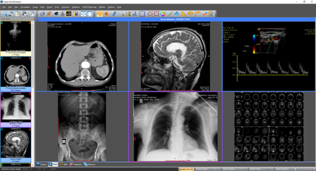 downloading Sante DICOM Editor 8.2.8