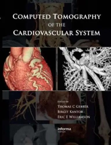 Computed Tomography of the Cardiovascular System (repost)