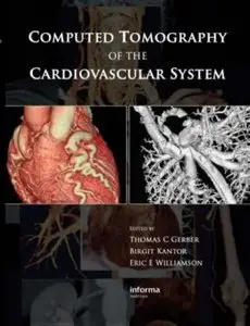 Computed Tomography of the Cardiovascular System (repost)