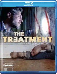 The Treatment (2014)