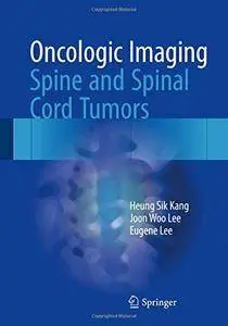 Oncologic Imaging: Spine and Spinal Cord Tumors [Repost]
