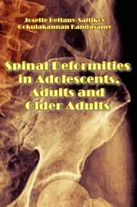 "Spinal Deformities in Adolescents, Adults and Older Adults" ed. by Josette Bettany-Saltikov, Gokulakannan Kandasamy