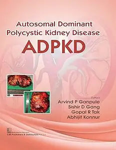 Autosomal Dominant Polytechnic Kidney Disease ADPKD