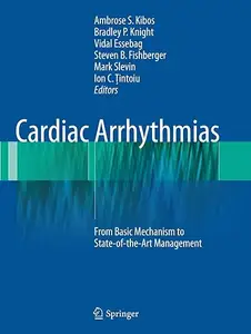 Cardiac Arrhythmias: From Basic Mechanism to State-of-the-Art Management (Repost)