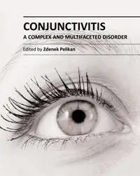 "Conjunctivitis: A Complex and Multifaceted Disorder" ed. by Zdenek Pelikan (Repost)