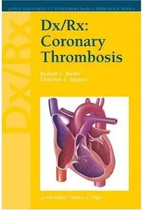 Dx/Rx: Coronary Thrombosis